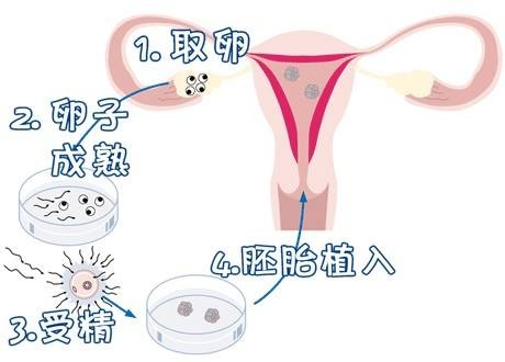 优胚鲜胚移植医学中心